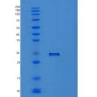 人Ras同源基因家族成员Q(RHOQ)重组蛋白