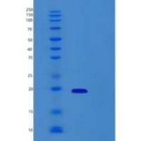 人RNA结合基元蛋白3(RBM3)重组蛋白