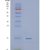 人环指蛋白7(RNF7)重组蛋白