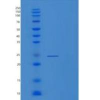 人RAB18重组蛋白
