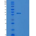 人DNA修复蛋白RAD51同系物4（rad 51d）重组蛋白
