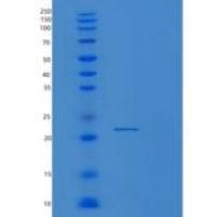 小鼠Raet1e重组蛋白
