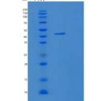 人RAB3IL重组蛋白