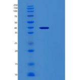 人网钙蛋白3(RCN3)重组蛋白
