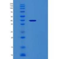 人网钙蛋白3(RCN3)重组蛋白