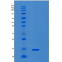 人RPL35A重组蛋白