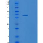 人NA修复蛋白RAD51同源物2（rad 51b）重组蛋白