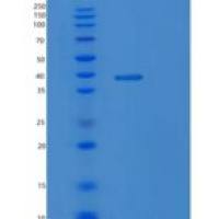 人NA修复蛋白RAD51同源物2（rad 51b）重组蛋白