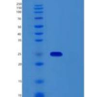 人RBM18重组蛋白