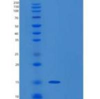 人ROBLD3重组蛋白