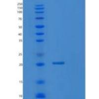 人Ras相关C3肉毒菌毒素底物3(Rac3)重组蛋白