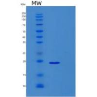 人RPL26重组蛋白