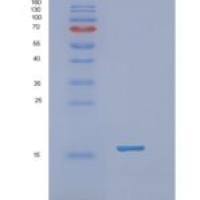 人视黄醇结合蛋白2(RBP2)重组蛋白