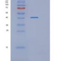 人RASSF1A重组蛋白