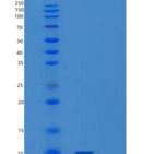 人受体活性修饰蛋白1(RAMP1)重组蛋白