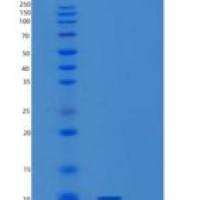 人受体活性修饰蛋白1(RAMP1)重组蛋白