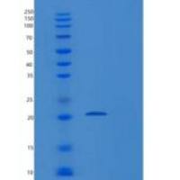 人Ras相关C3肉毒菌毒素底物1(Rac1)重组蛋白