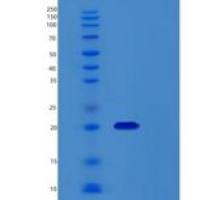 人2’-脱氧核苷5’-磷酸N-水解酶1（RCL）重组蛋白