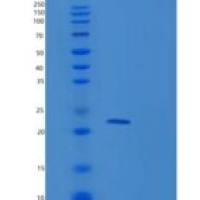 人RAP2B重组蛋白