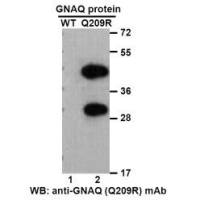 Gαq(Q209R)