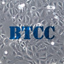 HUCCT1人胆管癌细胞