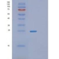 人蛋白信号调节因子16(RGS16)重组蛋白