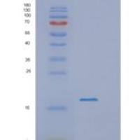 人视黄醇结合蛋白5(RBP5)重组蛋白