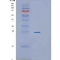 人RAS癌基因家族成员RAB1A(RAB1A)重组蛋白
