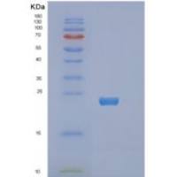 人环指蛋白4(RNF4)重组蛋白