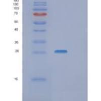 人蛋白信号调节因子4(RGS4)重组蛋白