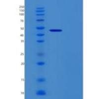 人RBM17重组蛋白