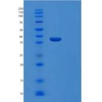 人视黄醛结合蛋白1(RLBP1)重组蛋白