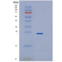 人RAB22A重组蛋白