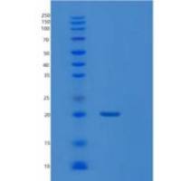 人核糖核酸酶A3(RNASE3)重组蛋白