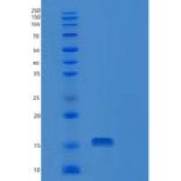 人核糖核酸酶A7(RNASE7)重组蛋白