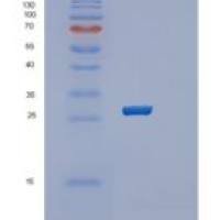 人RAB39B重组蛋白