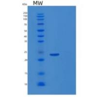 人Ras相关C3肉毒菌毒素底物2(Rac2)重组蛋白