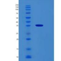 人RBM11重组蛋白