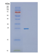 人V-Ral猴白血病病毒癌基因同源物A(RALA)重组蛋白