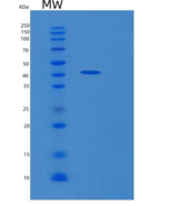 人环指蛋白34(RNF34)重组蛋白