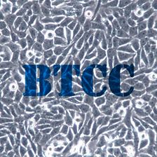 HGC-27人胃癌细胞