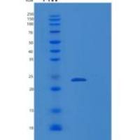 人RABL5重组蛋白