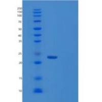 人RAP2A重组蛋白