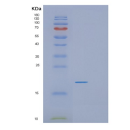 人蛋白信号调节因子21(RGS21)重组蛋白