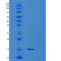 人RPL34重组蛋白