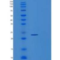 人丝氨酸水解酶RBBP9(RBBP9)重组蛋白