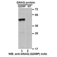 Gαq(Q209P)