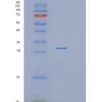 人RASSF3重组蛋白