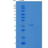 人RAB6A重组蛋白
