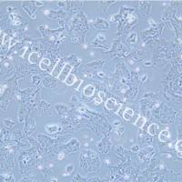 JHH-7细胞、JHH7细胞、JHH-7、JHH7、人肝癌细胞/STR鉴定/镜像绮点（Cellverse）